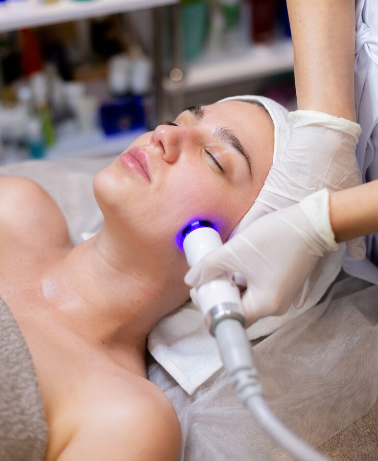 Radiofrecuencia facial